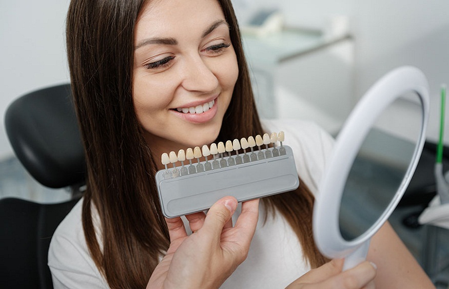 Process of Porcelain Veneers